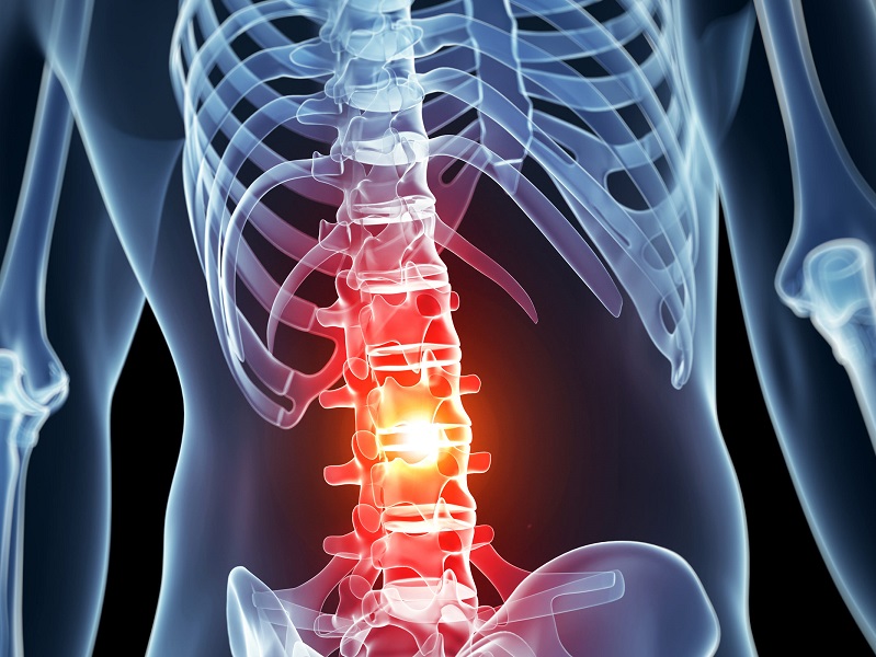 Spinal Cord Injury Awareness